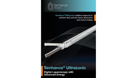 ultrasonic