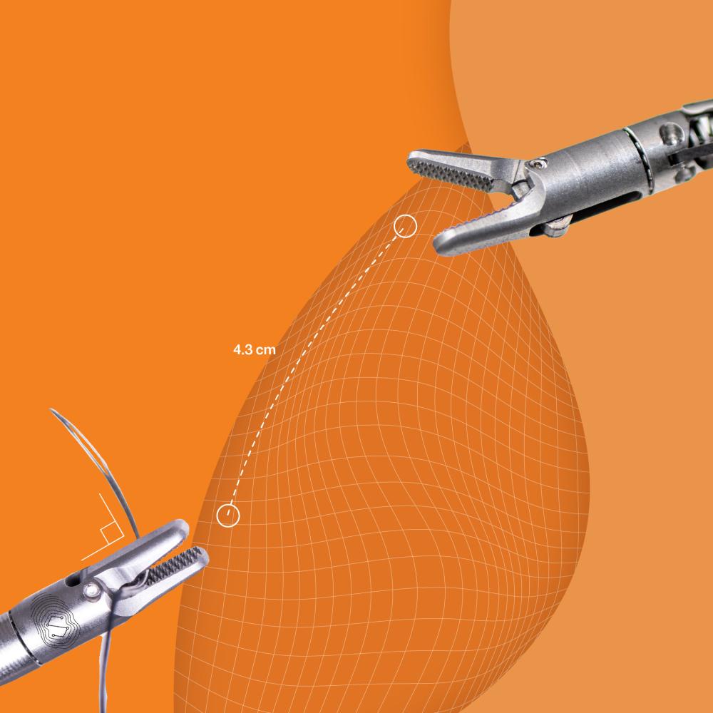 A pair of surgical gripping tips on an orange background